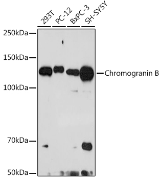 Chromogranin B Rabbit monoclonal antibody