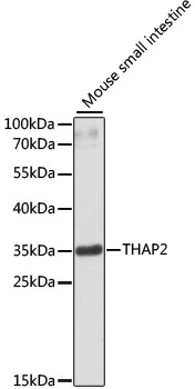 THAP2 Rabbit polyclonal antibody