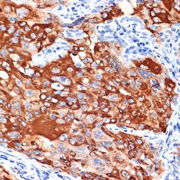 IL13RA1 Rabbit monoclonal antibody
