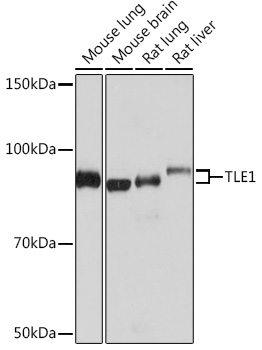 TLE1 Rabbit monoclonal antibody