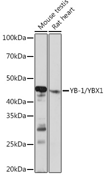 YB-1/YBX1 Rabbit monoclonal antibody