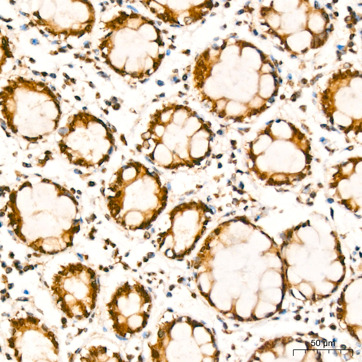 YB-1/YBX1 Rabbit monoclonal antibody