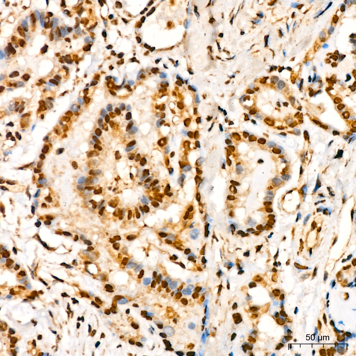 YB-1/YBX1 Rabbit monoclonal antibody