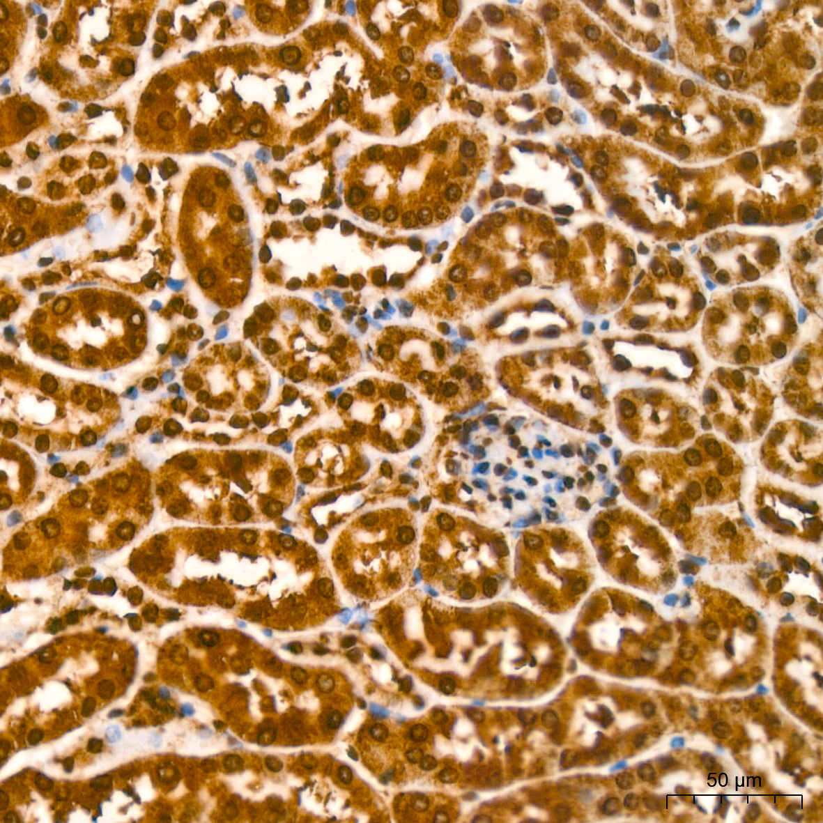 YB-1/YBX1 Rabbit monoclonal antibody