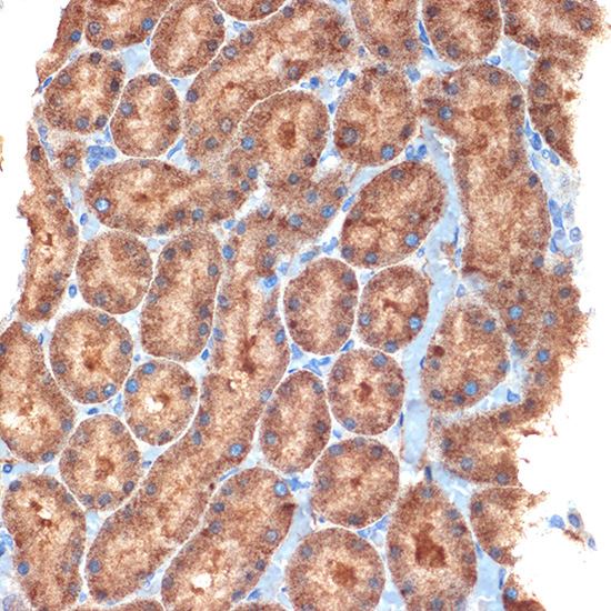 NEK6 Rabbit monoclonal antibody
