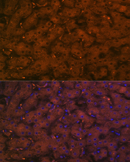 Complement C4A Rabbit monoclonal antibody