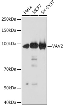 VAV2 Rabbit monoclonal antibody