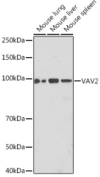VAV2 Rabbit monoclonal antibody