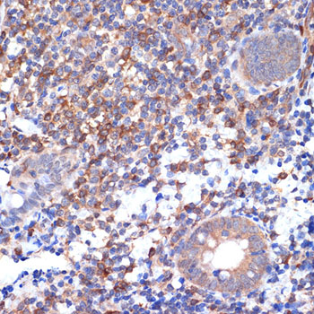 VAV2 Rabbit monoclonal antibody