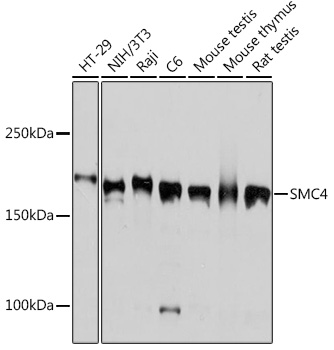 SMC4 Rabbit monoclonal antibody