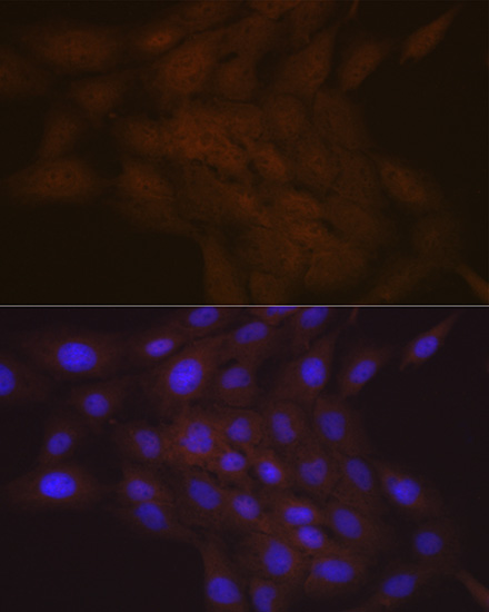 SMC4 Rabbit monoclonal antibody
