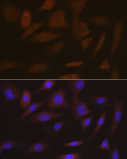 SMC4 Rabbit monoclonal antibody