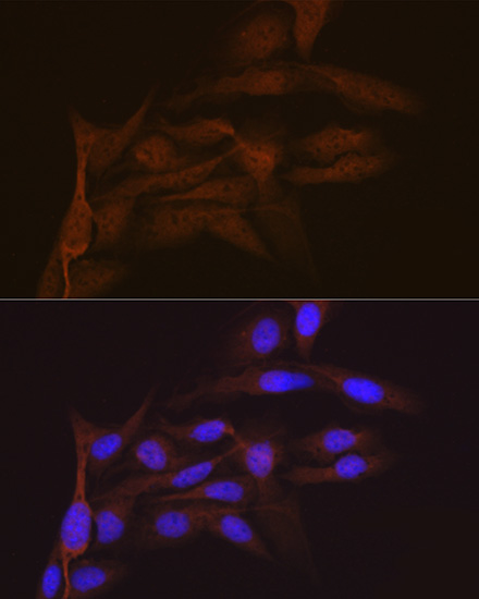 SMC4 Rabbit monoclonal antibody