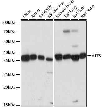 ATF5 Rabbit monoclonal antibody