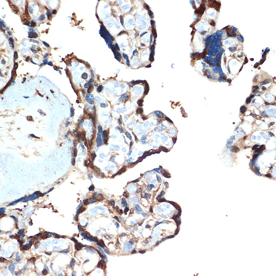 ATF5 Rabbit monoclonal antibody