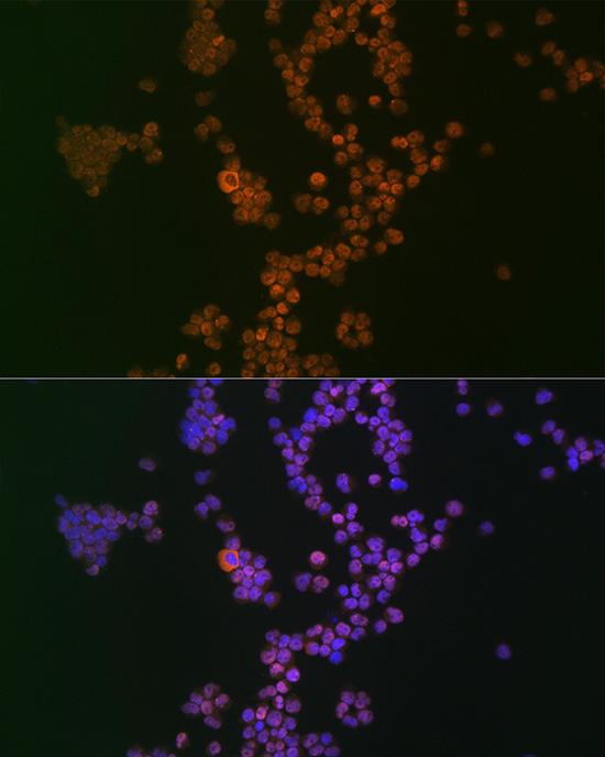 Ikaros Rabbit monoclonal antibody