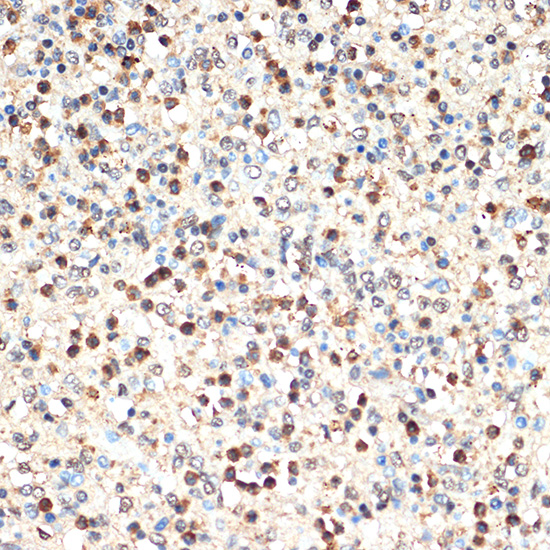 SHIP1 Rabbit monoclonal antibody