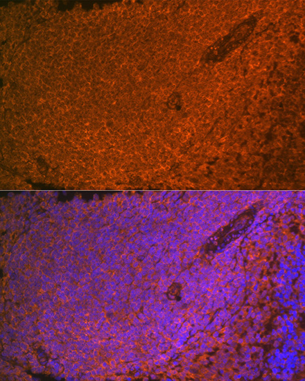 SHIP1 Rabbit monoclonal antibody
