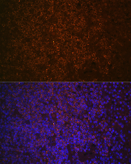 SHIP1 Rabbit monoclonal antibody