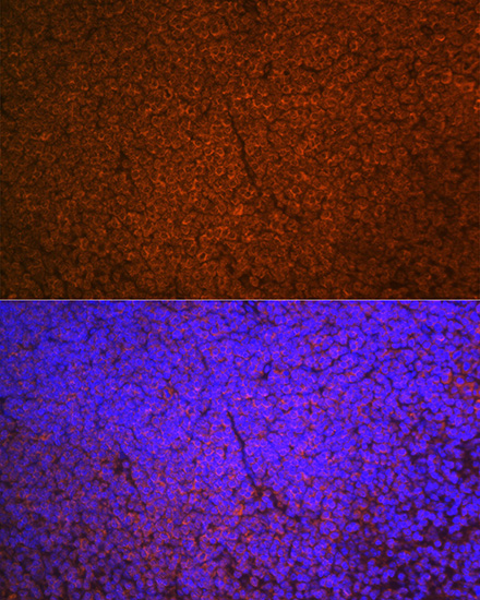 SHIP1 Rabbit monoclonal antibody
