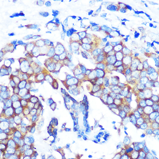 HDAC6 Rabbit monoclonal antibody