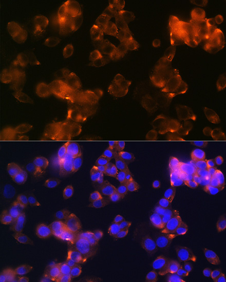 [KO Validated] NRF2 Rabbit monoclonal antibody