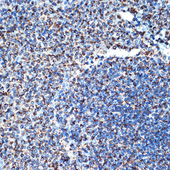 DCR2 Rabbit monoclonal antibody