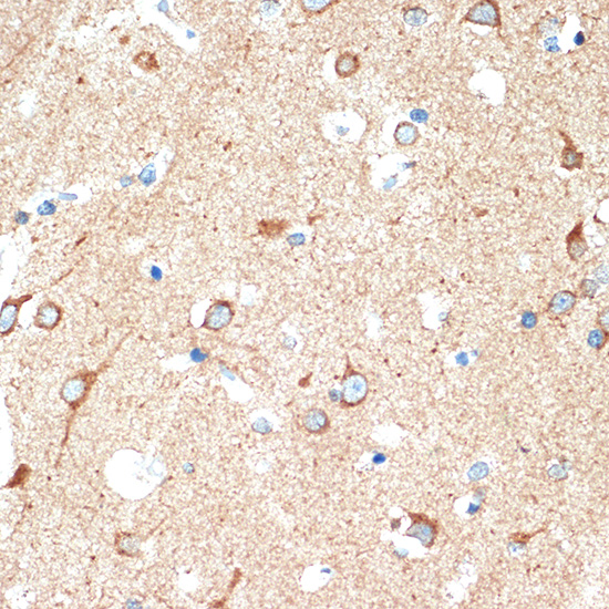 DCR2 Rabbit monoclonal antibody
