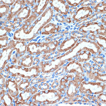 DCR2 Rabbit monoclonal antibody