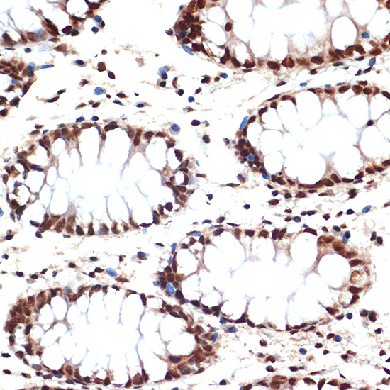 CDC16 Rabbit monoclonal antibody