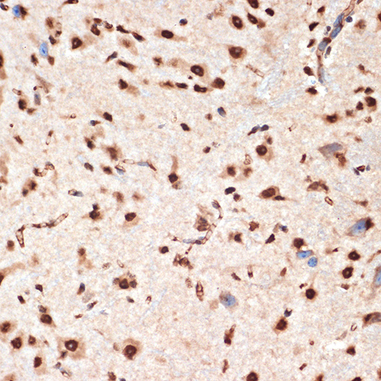 CDC16 Rabbit monoclonal antibody