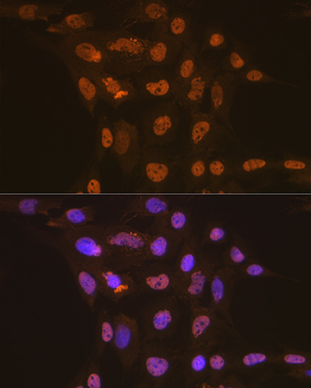 CDC16 Rabbit monoclonal antibody