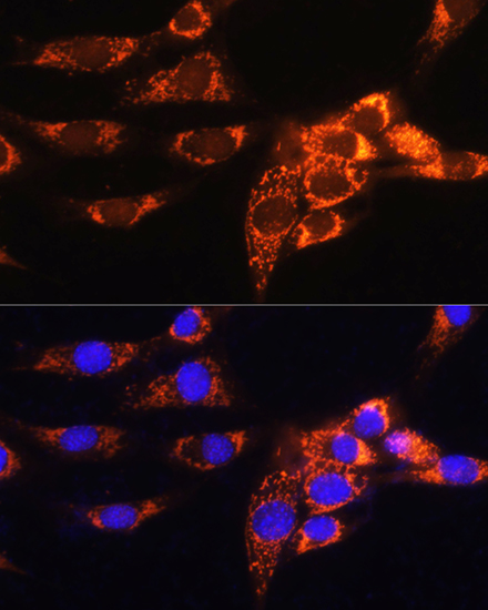 AMPD1 Rabbit polyclonal antibody