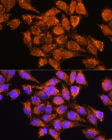 AMPD1 Rabbit polyclonal antibody