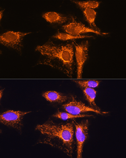 AMPD1 Rabbit polyclonal antibody