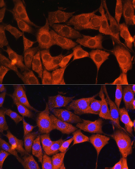 AOX1 Rabbit polyclonal antibody