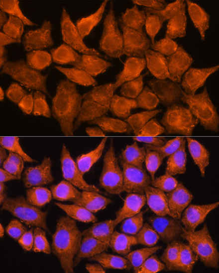 AOX1 Rabbit polyclonal antibody