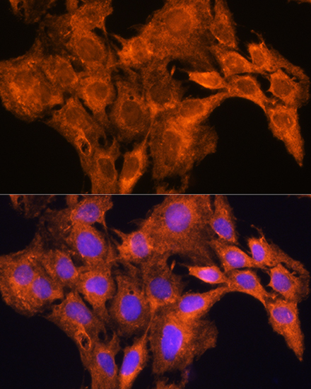 AOX1 Rabbit polyclonal antibody