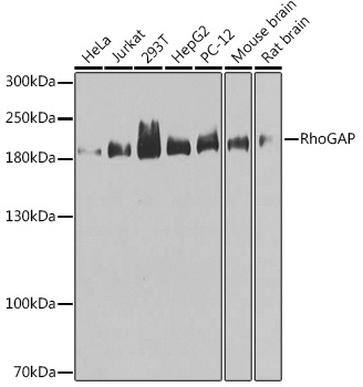 RhoGAP Rabbit polyclonal antibody
