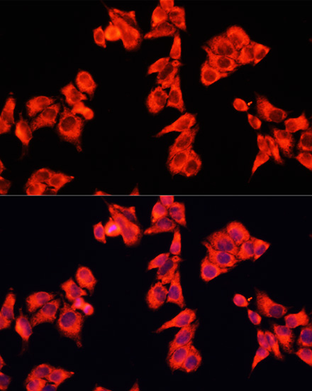 RhoGAP Rabbit polyclonal antibody