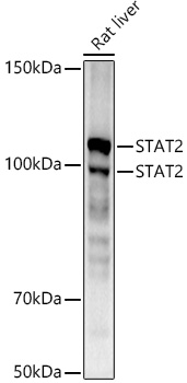 [KD Validated] STAT2 Rabbit monoclonal antibody