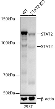 [KD Validated] STAT2 Rabbit monoclonal antibody