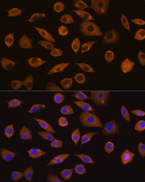 DOCK2 Rabbit polyclonal antibody