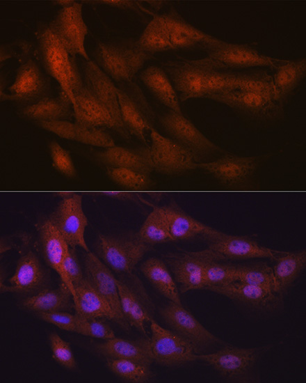 K48-linkage Specific Ubiquitin Rabbit monoclonal antibody