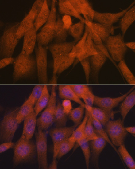 K48-linkage Specific Ubiquitin Rabbit monoclonal antibody