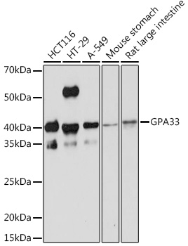 GPA33 Rabbit monoclonal antibody