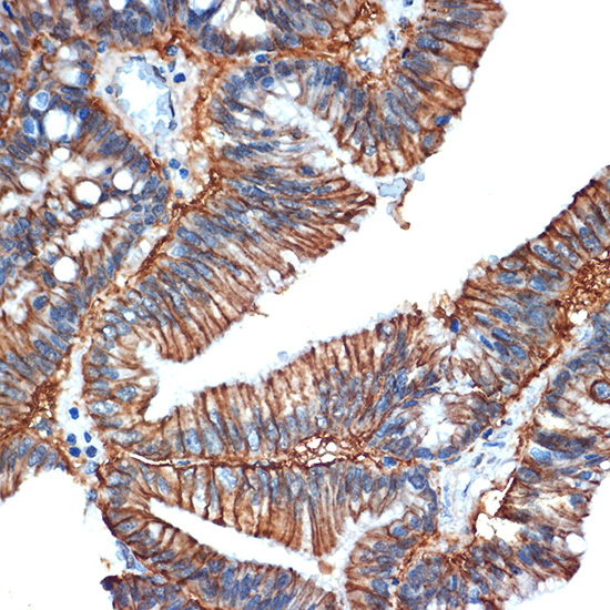 GPA33 Rabbit monoclonal antibody