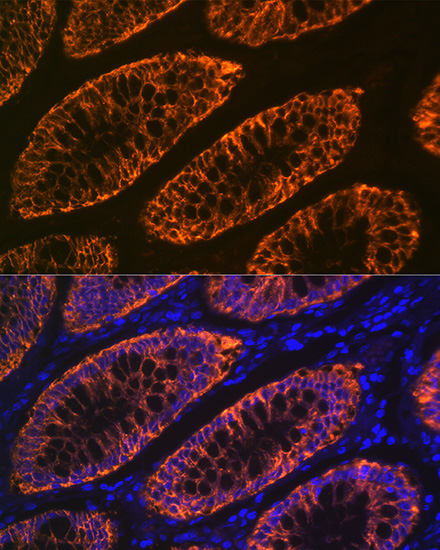 GPA33 Rabbit monoclonal antibody