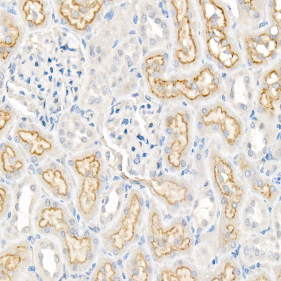 LRP2 Rabbit polyclonal antibody