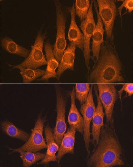 Rap1GAP Rabbit monoclonal antibody